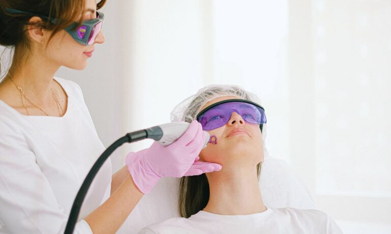 Acne Scar treatment