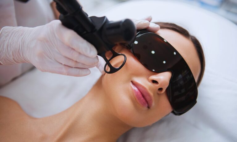 CO2 Laser in Hyderabad: Best Treatment for Acne Scars, Wrinkles & Skin Rejuvenation